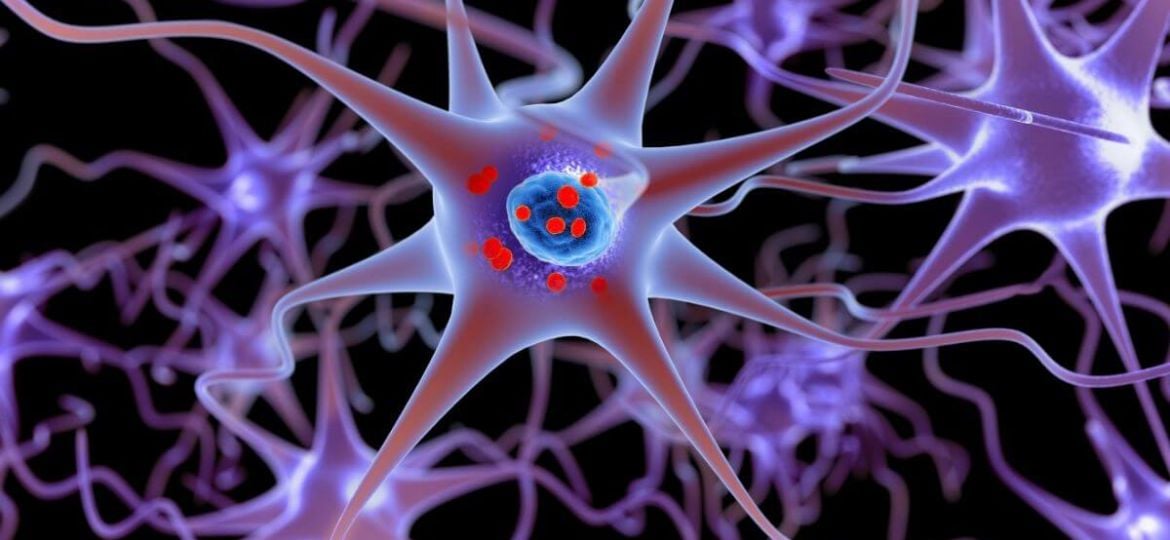 How Are Gaucher and Parkinson’s Disease Related?