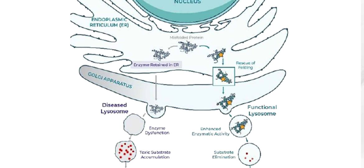 Lead Program in GBA-Parkinson’s Disease