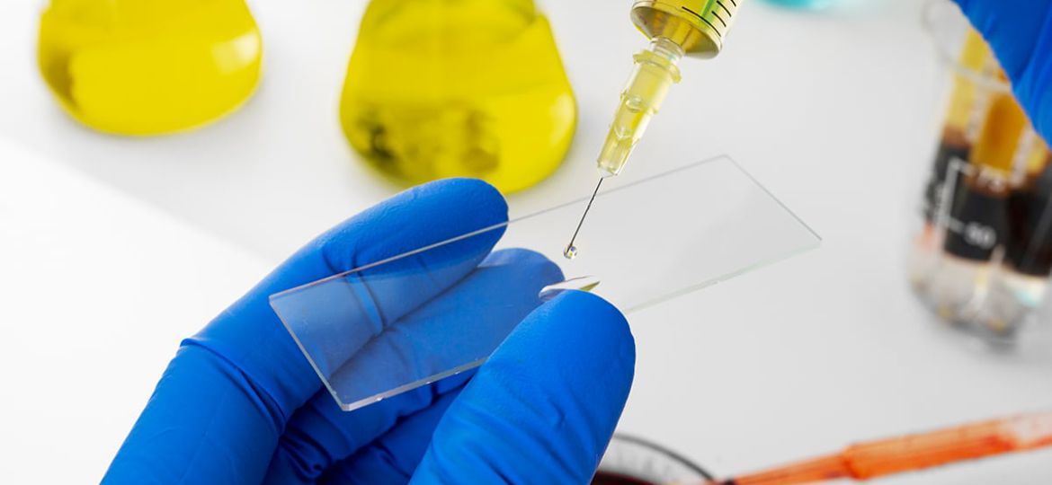 MJFF announces a historic breakthrough in the development of Parkinson’s disease detection and diagnosis
